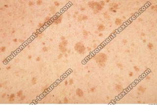 human skin white 0023